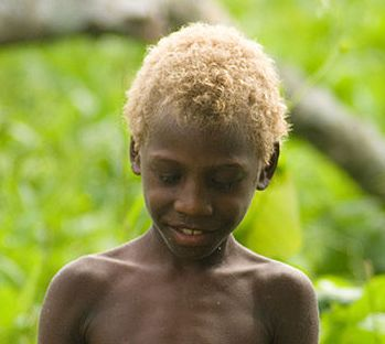 Illustration for article titled The Mystery of Solomon Island Blonds